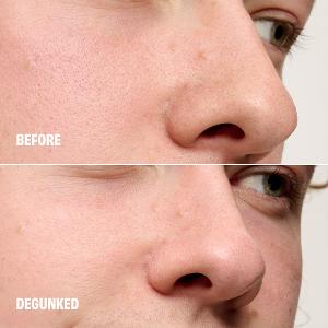 benefit 粉刺byebye刮刮棒