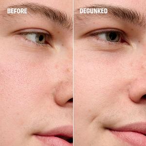 benefit 粉刺byebye刮刮棒