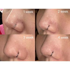 benefit 粉刺byebye刮刮棒