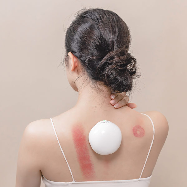 3ZeBra 舒浮罐︱智能負壓刮痧拔罐器