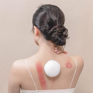 3ZeBra 舒浮罐︱智能負壓刮痧拔罐器